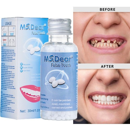 Kit fake teeth - kit, permanent