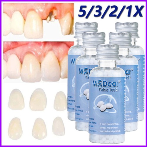 Strong teeth tooth repair - teeth,