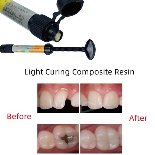 New dental cement - dental, tooth